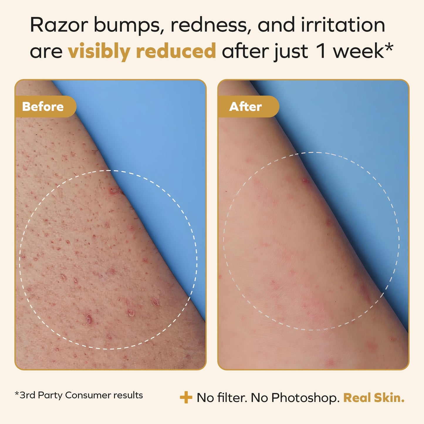HoneyHours™ Ingrown Hair Smoothing Solution